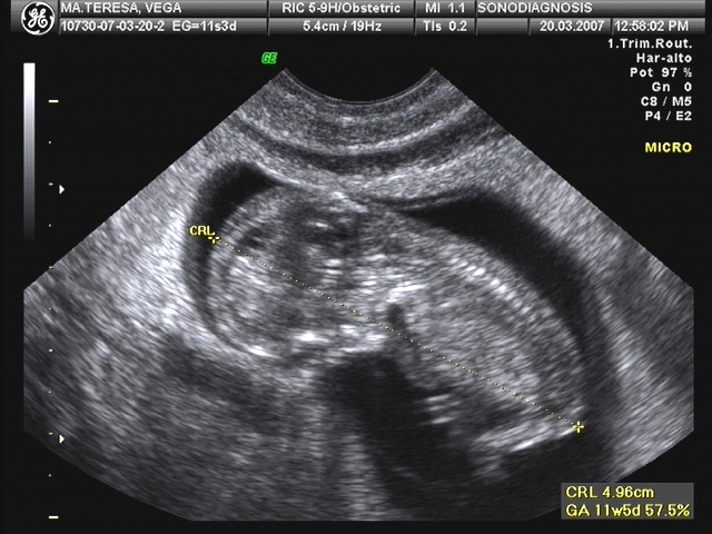Ultrasonidos durante el Embarazo. | InterClinic Coapa
